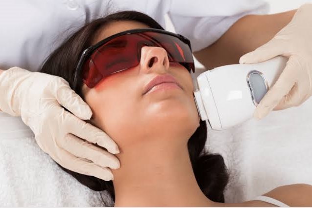 Laser Hair Removal